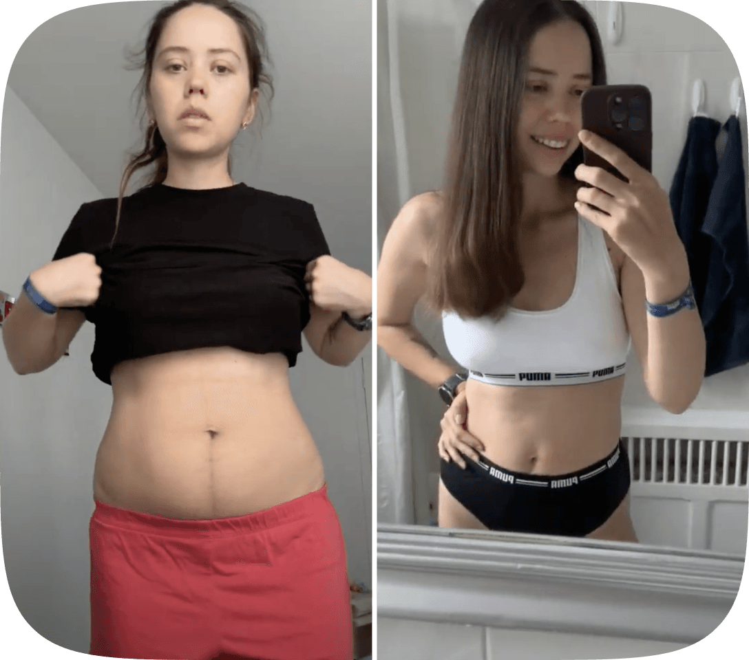 Daniella Before After